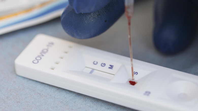Primele 40.000 de teste rapide pe bază de antigen vor ajunge săptămâna viitoare în spitale