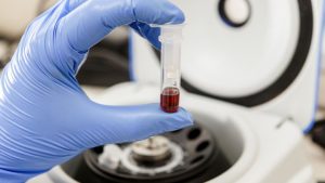  Teste prenatale „made in China” colectează pentru armata chineză datele genetice ale femeilor însărcinate