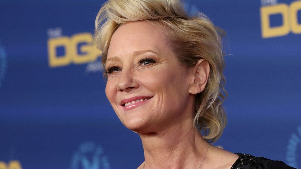 Actrița americană Anne Heche a fost declarată decedată