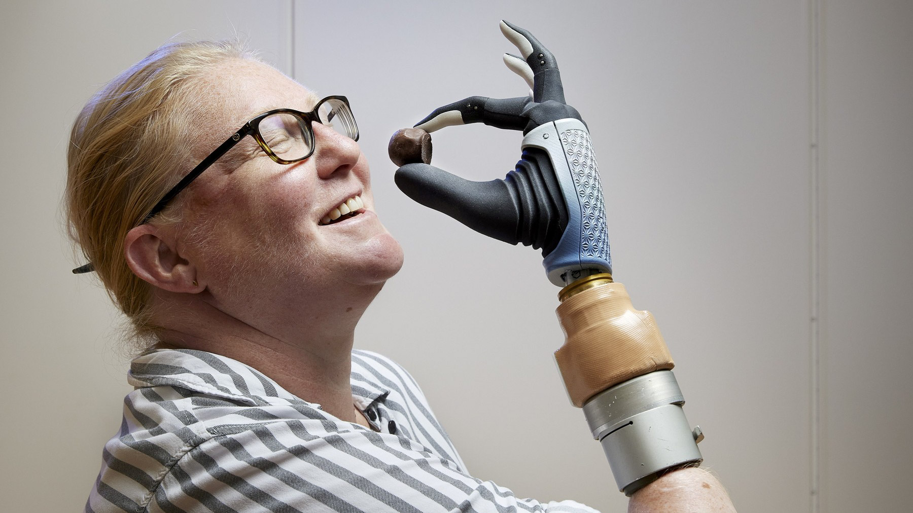 Mâna bionică fuzionează cu corpul unei femei