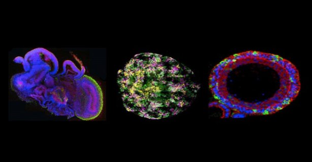 Organe noi generate din celule prelevate din lichid amniotic