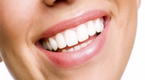 white-teeth-925x425-1-300x166 white-teeth-925x425