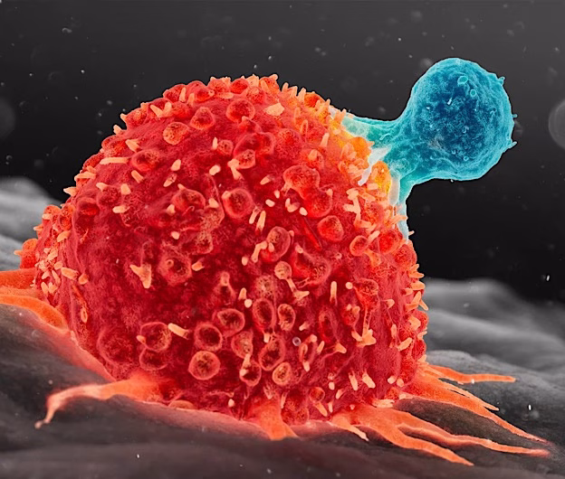Descoperire revoluționară în tratamentul cancerului