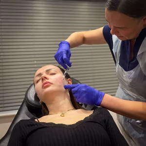 tratamente-faciale-300x300 tratamente faciale