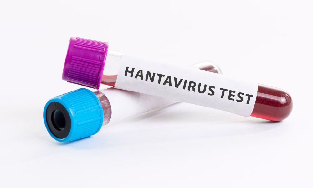 cazuri confirmate, focar nava croaziera, hantavirus, Oceanul Atlantic, Organizaţia Mondială a Sănătăţii