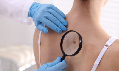 cancer de piele, rezultate promițătoare, studii clinice, tumorile avansate, vaccin experimental