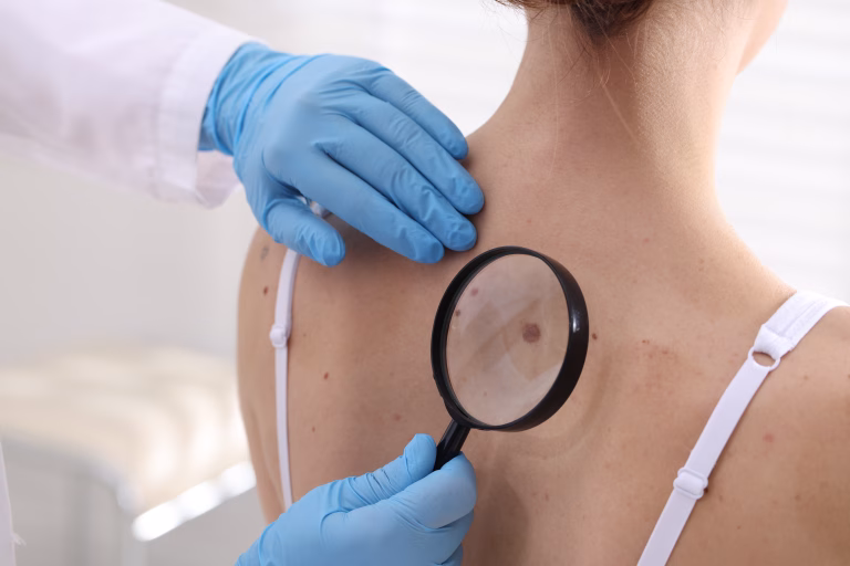 Vaccin experimental promite soluții pentru pacienții cu cancer de piele avansat