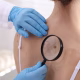 cancer de piele, rezultate promițătoare, studii clinice, tumorile avansate, vaccin experimental